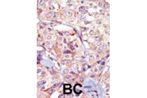 Immunohistochemistry (IHC) image for anti-Germ Cell Associated 2 (Haspin) (GSG2) antibody (ABIN3003656) (GSG2 抗体)