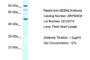 Western Blotting (WB) image for anti-Sestrin 2 (SESN2) (C-Term) antibody (ABIN786225) (Sestrin 2 抗体  (C-Term))