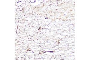 Immunohistochemistry (IHC) image for anti-Glial Fibrillary Acidic Protein (GFAP) (C-Term) antibody (ABIN3020751)