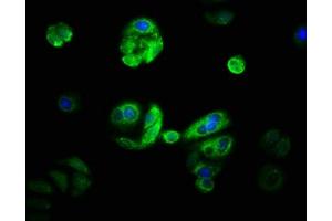 Immunofluorescence staining of HepG2 with ABIN7170757 at 1:33, counter-stained with DAPI. (CYP21A2 抗体  (AA 312-418))