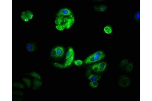Immunofluorescence (IF) image for anti-Cytochrome P450, Family 21, Subfamily A, Polypeptide 2 (CYP21A2) (AA 312-418) antibody (ABIN7170757)