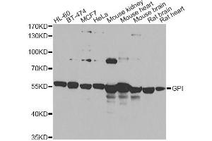 Western blot analysis of extracts of various cell lines, using GPI antibody (ABIN6292114) at 1:1000 dilution. (GPI 抗体)