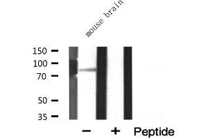 Western blot analysis of extracts from mouse brain, using MARK3 antibody. (MARK3 抗体  (N-Term))