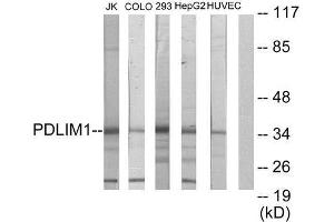 Western Blotting (WB) image for anti-PDZ and LIM Domain 1 (PDLIM1) (Internal Region) antibody (ABIN1848910) (PDLIM1 抗体  (Internal Region))