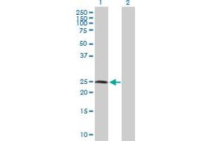 Western Blot analysis of RNF114 expression in transfected 293T cell line by RNF114 MaxPab polyclonal antibody. (RNF114 抗体  (AA 1-228))