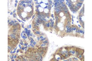 Immunohistochemistry analysis of paraffin-embedded mouse colon using FAS Monoclonal Antibody at dilution of 1:200. (FAS 抗体)