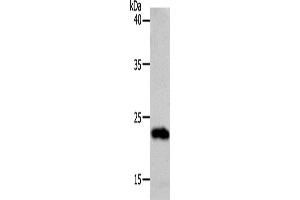 Western Blotting (WB) image for anti-Suppressor of Cytokine Signaling 1 (SOCS1) antibody (ABIN2426412) (SOCS1 抗体)