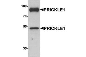 Western blot analysis of PRICKLE1 in human bladder tissue lysate with PRICKLE1 antibody at 1 ug/mL. (PRICKLE1 抗体  (C-Term))