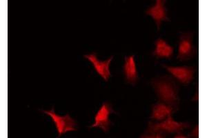 ABIN6267272 staining 293 by IF/ICC. (c-MYC 抗体  (pThr58))