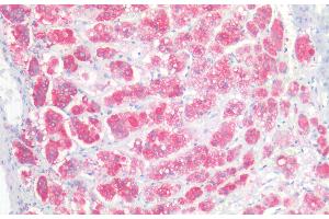 Immunohistochemistry (IHC) image for anti-Neural Cell Adhesion Molecule 1 (NCAM1) (Internal Region) antibody (ABIN768541)
