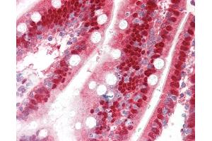 Immunohistochemistry (IHC) image for anti-Sulfotransferase Family, Cytosolic, 1A, Phenol-Preferring, Member 1 (SULT1A1) (N-Term) antibody (ABIN6755318)