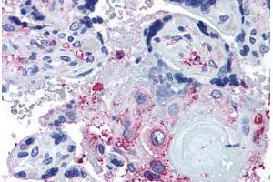 Anti-ADAMTS5 antibody  ABIN1048293 IHC staining of human placenta.