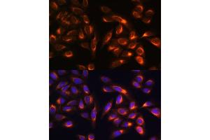 Immunofluorescence analysis of U-2 OS cells using PTCD1 antibody (ABIN7269203) at dilution of 1:100. (PTCD1 抗体  (AA 435-537))