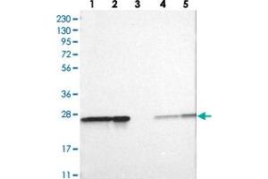 Western blot analysis of Lane 1: RT-4, Lane 2: U-251 MG, Lane 3: Human Plasma, Lane 4: Liver, Lane 5: Tonsil with PSMA2 polyclonal antibody . (PSMA2 抗体)