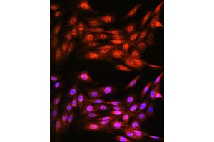 Immunofluorescence analysis of C6 cells using VCP Rabbit mAb (ABIN7271284) at dilution of 1:100 (40x lens). (VCP 抗体)