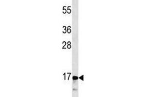 CGRP antibody western blot analysis in CEM lysate (CGRP 抗体  (AA 56-84))