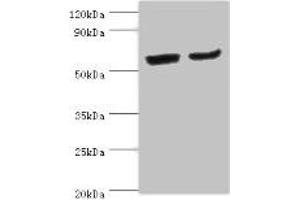 Western blot All lanes: CYP2J2 antibody at 4 μg/mL Lane 1: Mouse skeletal muscle tissue Lane 2: Rat liver tissue Secondary Goat polyclonal to rabbit IgG at 1/10000 dilution Predicted band size: 58 kDa Observed band size: 58 kDa (CYP2J2 抗体  (AA 328-502))