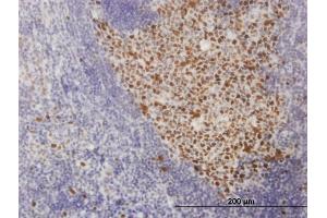 Immunoperoxidase of monoclonal antibody to SOX9 on formalin-fixed paraffin-embedded human tonsil. (SOX9 抗体  (AA 400-509))