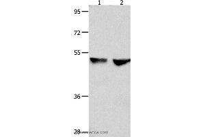 Western blot analysis of 823 and Hela cell , using CDK9 Polyclonal Antibody at dilution of 1:300 (CDK9 抗体)