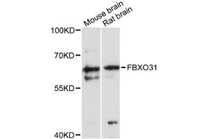 Western blot analysis of extracts of various cell lines, using FBXO31 antibody (ABIN6291619) at 1:3000 dilution. (FBXO31 抗体)