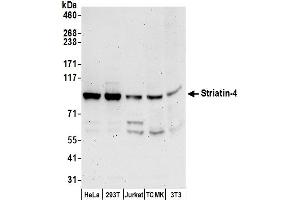 anti-Striatin, Calmodulin Binding Protein 4 (STRN4) (AA 325-375) antibody