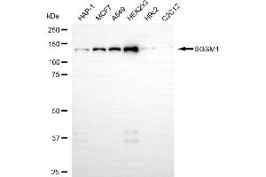 anti-Small G Protein Signaling Modulator 1 (SGSM1) antibody