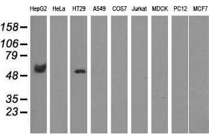 Western blot analysis of extracts (35 µg) from 9 different cell lines by using anti-CORO1B monoclonal antibody. (CORO1B 抗体)