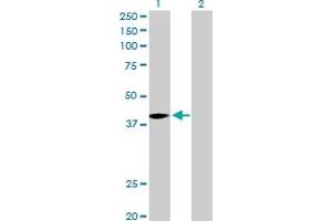 Western Blotting (WB) image for anti-Melanoma Antigen Family A, 9 (MAGEA9) (AA 1-315) antibody (ABIN517698)