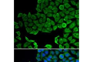 Immunofluorescence analysis of A549 cells using VPS4A Polyclonal Antibody (VPS4A 抗体)