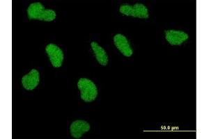 Immunofluorescence of monoclonal antibody to PPARBP on HeLa cell. (MED1 抗体  (AA 1391-1490))