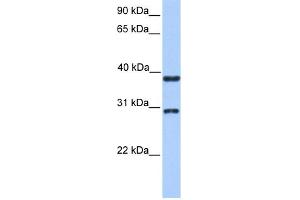 WB Suggested Anti-KLHDC1 Antibody Titration: 0. (KLHDC1 抗体  (N-Term))