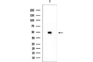 anti-Papillary Renal Cell Carcinoma (Translocation-Associated) (PRCC) antibody