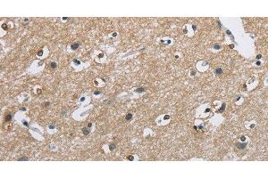 Immunohistochemistry of paraffin-embedded Human brain using CAB39L Polyclonal Antibody at dilution of 1:40 (CAB39L 抗体)