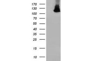 Western Blotting (WB) image for anti-Microtubule Associated Monoxygenase, Calponin and LIM Domain Containing 1 (MICAL1) antibody (ABIN1499465)