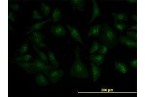 Image no. 3 for anti-Zic Family Member 4 (ZIC4) (AA 249-320) antibody (ABIN466251) (ZIC4 抗体  (AA 249-320))