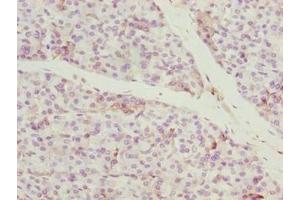 Immunohistochemistry of paraffin-embedded human pancreatic tissue using ABIN7148168 at dilution of 1:100 (CCDC89 抗体  (AA 1-200))