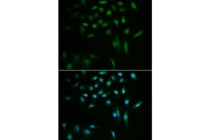 Immunofluorescence analysis of A549 cells using SUMO3 antibody (ABIN5971585). (SUMO3 抗体)