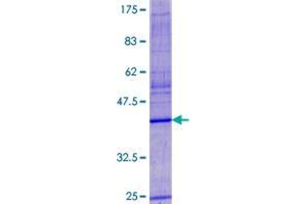 VKORC1 Protein (AA 1-163) (GST tag)