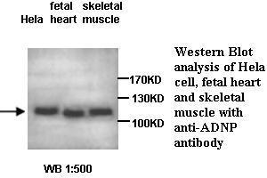 Image no. 1 for anti-Activity-Dependent Neuroprotector Homeobox (ADNP) antibody (ABIN1574495)