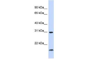 WB Suggested Anti-TNFSF14 Antibody Titration:  0. (TNFSF14 抗体  (Middle Region))