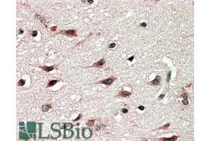 ABIN185356 (5µg/ml) staining of paraffin embedded Human Cerebral Cortex. (DYX1C1 抗体  (C-Term))