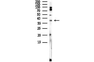 anti-PRKC, Apoptosis, WT1, Regulator (PAWR) (C-Term) antibody