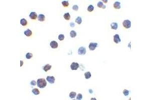 Immunocytochemistry of Bak in L1210 cells with AP30117PU-N Bak antibody at 2 μg/ml. (BAK1 抗体  (N-Term))