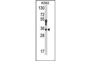 Western blot analysis of 17-beta-HSD3 / HSD17B3 Antibody (Center) in K562 cell line lysates (35ug/lane). (HSD17B3 抗体  (Middle Region))