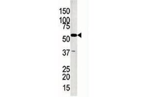 Glycerol kinase antibody used in western blot to detect GK2 in Jurkat lysate (GK2 抗体  (AA 487-515))