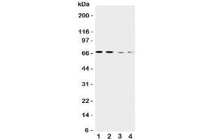 Western blot testing of CAT1 antibody and Lane 1:  human placenta;  2: HeLa;  3: SKOV-3;  4: HT1080 cell lysate. (SLC7A1 抗体  (C-Term))
