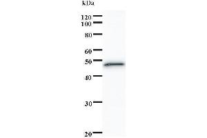 Western Blotting (WB) image for anti-SATB Homeobox 1 (SATB1) antibody (ABIN932488) (SATB1 抗体)