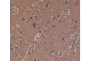 Used in DAB staining on fromalin fixed paraffin- embedded Kidney tissue (SNAP25 抗体  (AA 1-206))