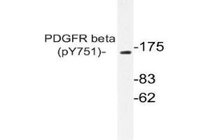 Western blot (WB) analysis of p-PDGFR beta antibody in extracts from NIH/3T3 PDGF cells . (PDGFRB 抗体  (pTyr751))