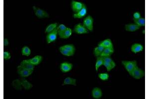Immunofluorescence staining of HepG2 cells with ABIN7144968 at 1:166, counter-stained with DAPI. (RECQL4 抗体  (AA 200-337))